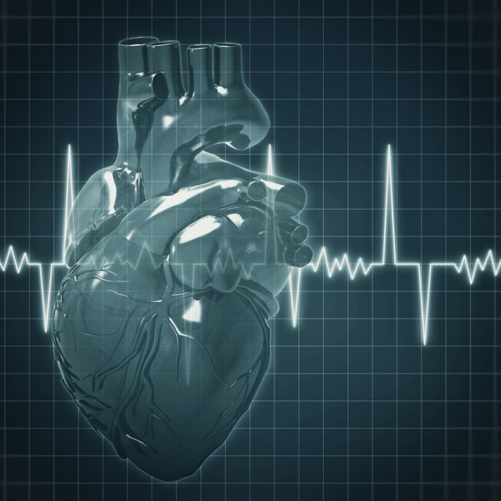 Cardiac Arrhythmia | Cardiovascular Medical Group of Southern California